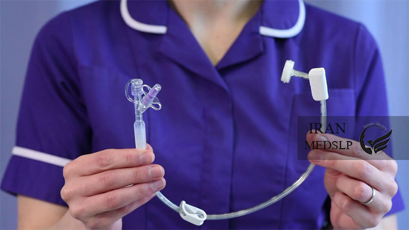 هر آنچه در مورد تغذیه از طریق گاستروستومی باید بدانید