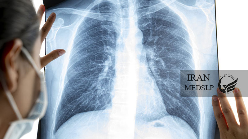 عفونت ریه و اختلال بلع